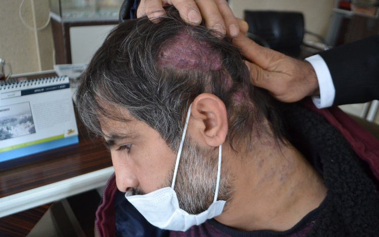 Gata ve Hacettepe’de teşhis koyamadı Gata ve Hacettepe’de teşhis koyamadı