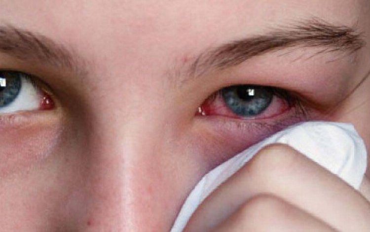 Göz yüzeyinde temizlenmeyen maddeler enfeksiyonu arttırıyor