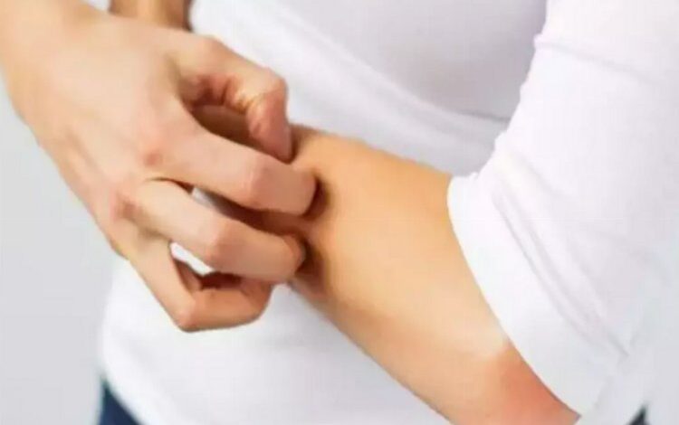 Zonanın en önemli nedeni stres Zonanın en önemli nedeni stres