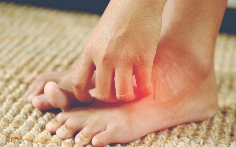 Dikkat! Bu hastalık yazın yaygınlaşıyor! Dikkat! Bu hastalık yazın yaygınlaşıyor!