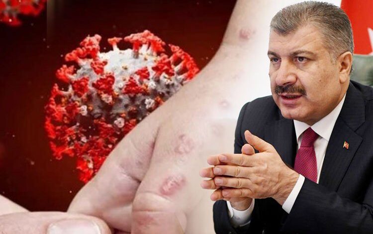 Eris varyantı Türkiye’de Eris varyantı Türkiye’de