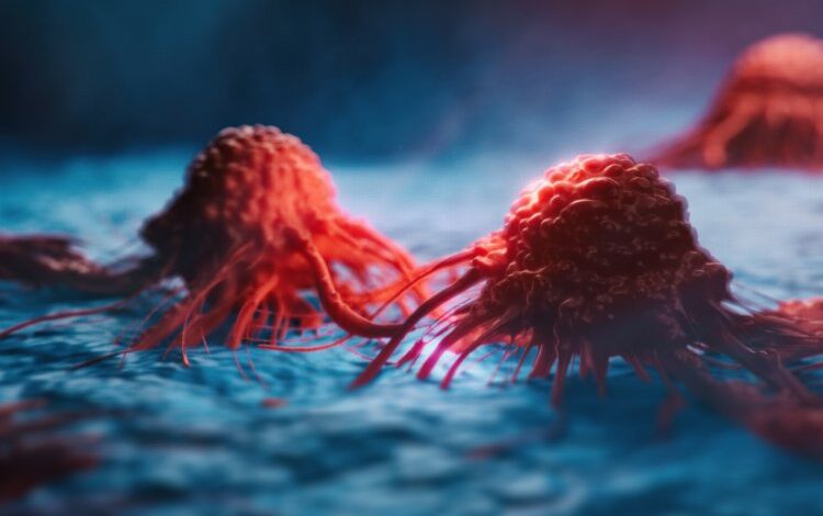 Kanser tedavisinde yol haritasını genetik testler belirliyor Kanser tedavisinde yol haritasını genetik testler belirliyor