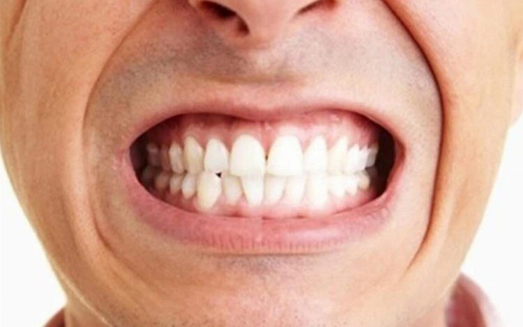 Diş sıkma problemini önemseyin! Diş sıkma problemini önemseyin!