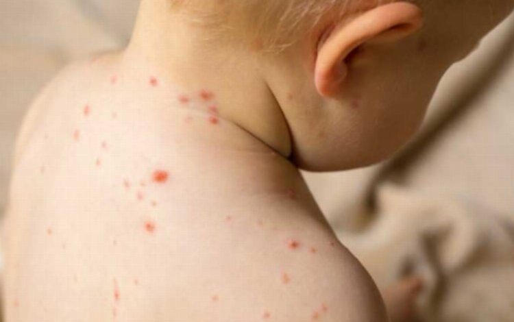 Risk grubundakiler için hayati tehlike olabiliyor