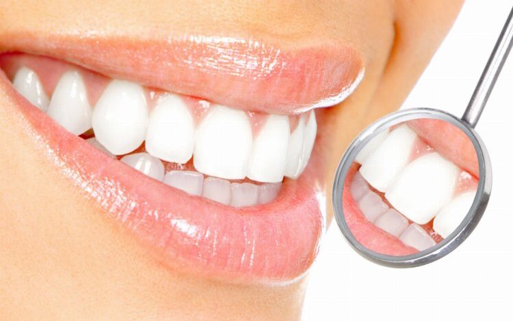 Diş beyazlatma kalıcı çözüm değil Diş beyazlatma kalıcı çözüm değil